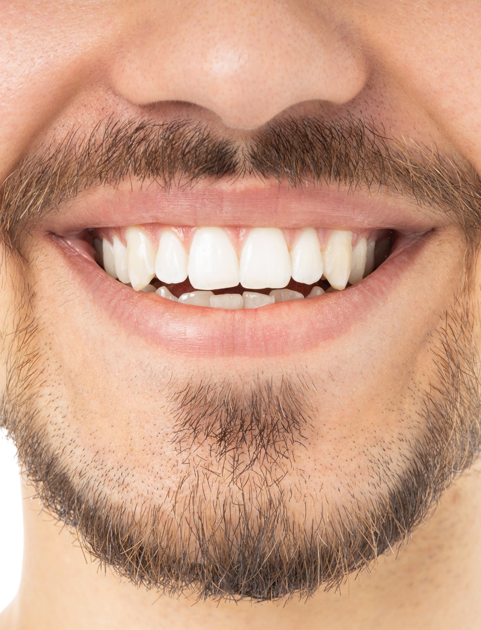 category-1